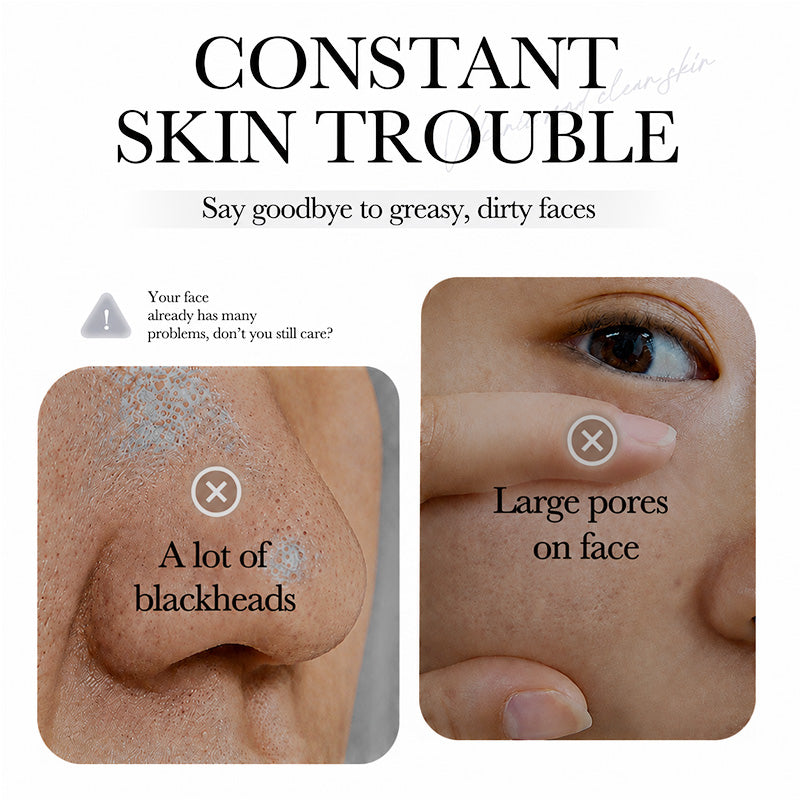 💥Hot Sale🍓Suncrese® 2026 Next-Gen Anti Pores & Acne Clay Mask Stick