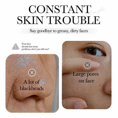 💥Hot Sale🍓Suncrese® 2026 Next-Gen Anti Pores & Acne Clay Mask Stick